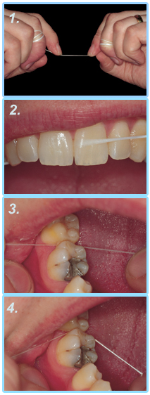 floss