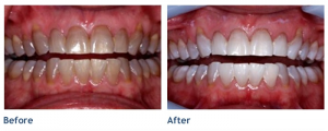 kor-whitening1-300x120